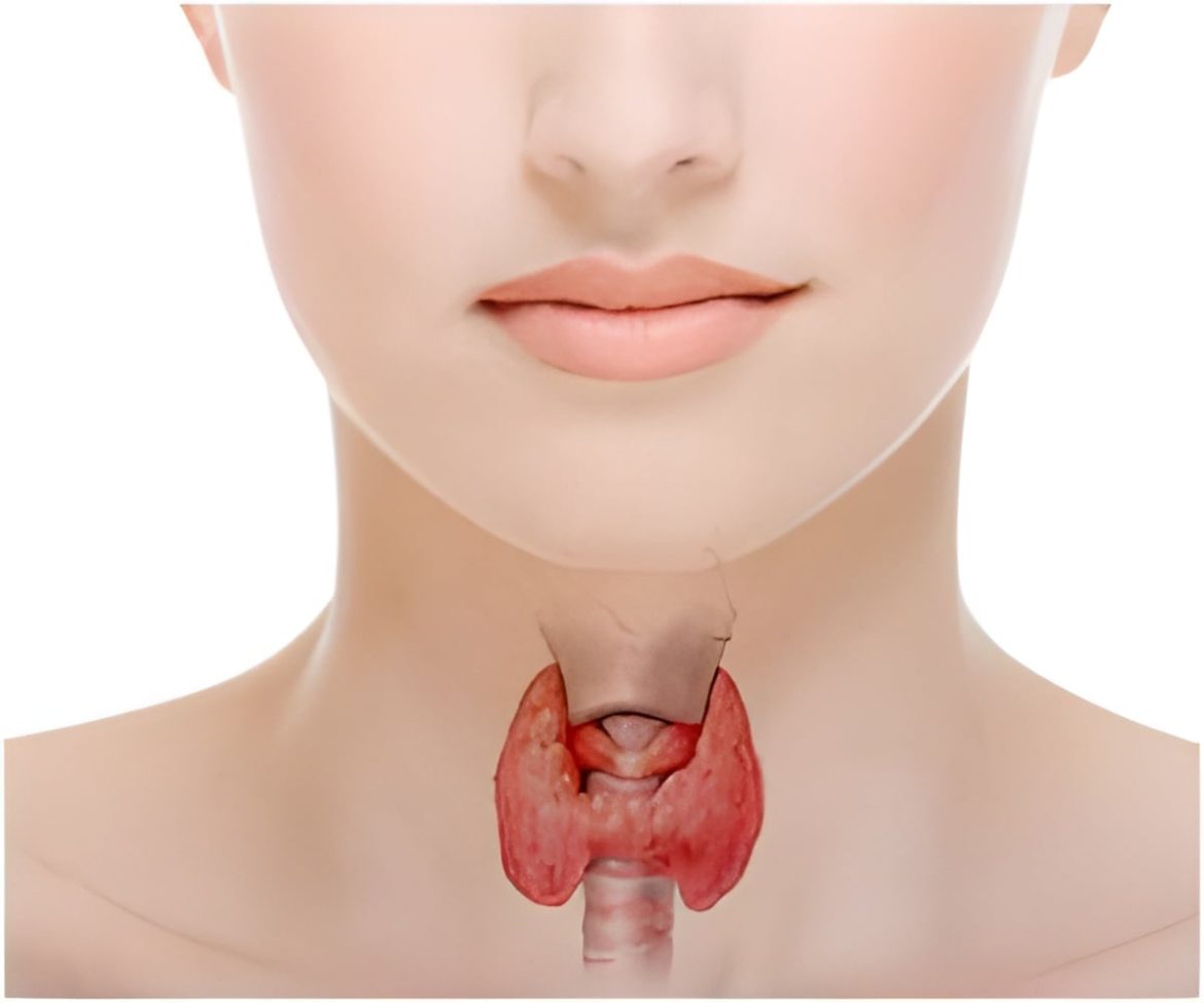 Reducing Thyroid Nodule Size Without Scars Using Innovative Ablation Technology