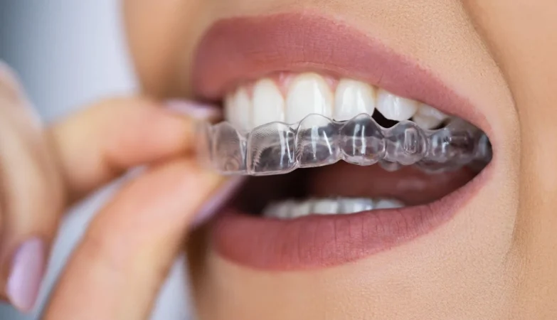 How Invisalign Affects Your Gum Health Throughout Orthodontic Treatment
