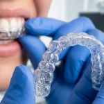 How Invisalign Corrects Overcrowding Without Requiring Tooth Extractions in Many Cases
